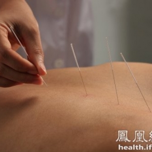 针灸天灸有区别 冬病夏治不当反毁身